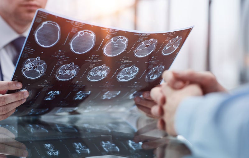 Doctor showing brain scans to a patient.
